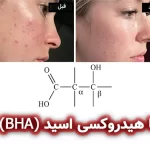 بتا هیدروکسی اسید (Beta hydroxy acid, BHA)