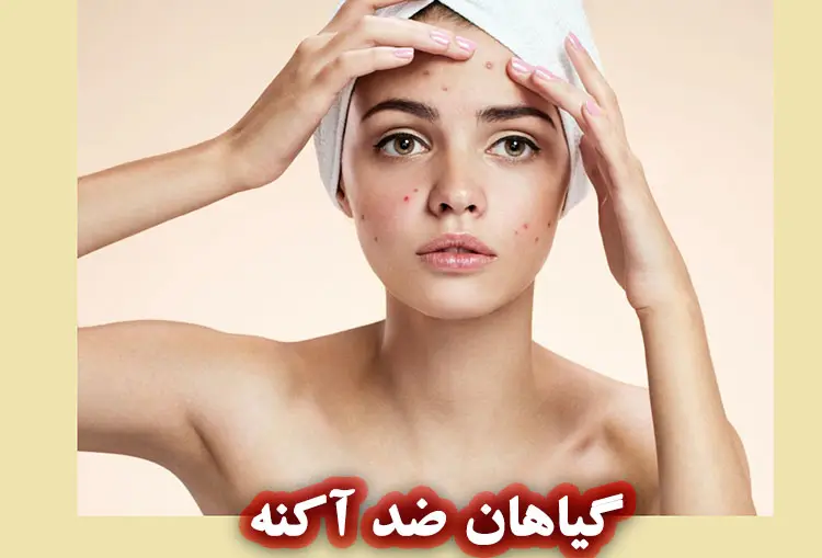 آکنه چیست؟