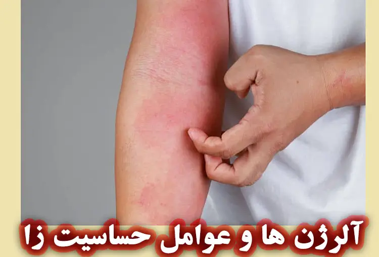 آلرژن و عوامل حساسیت زا در محصولات آرایشی