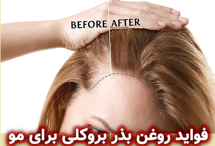 فواید روغن بذر بروکلی به مراقبت از مو