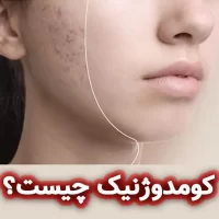 کومدوژنیک چیست؟