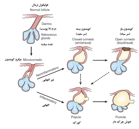 کومدون چیست و انواع آن کدام است؟