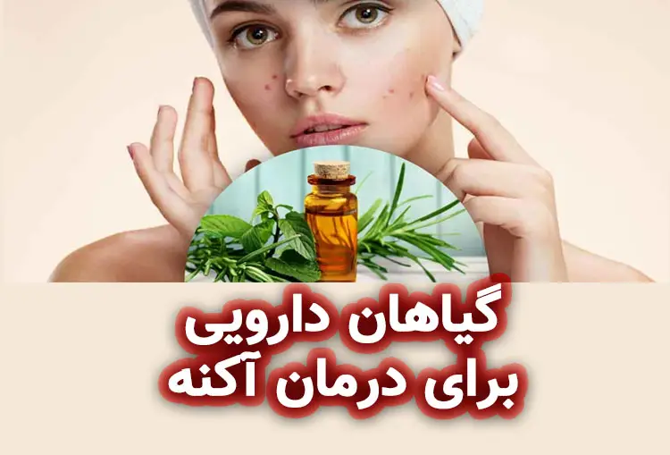 مروری بر گیاهان دارویی برای درمان آکنه