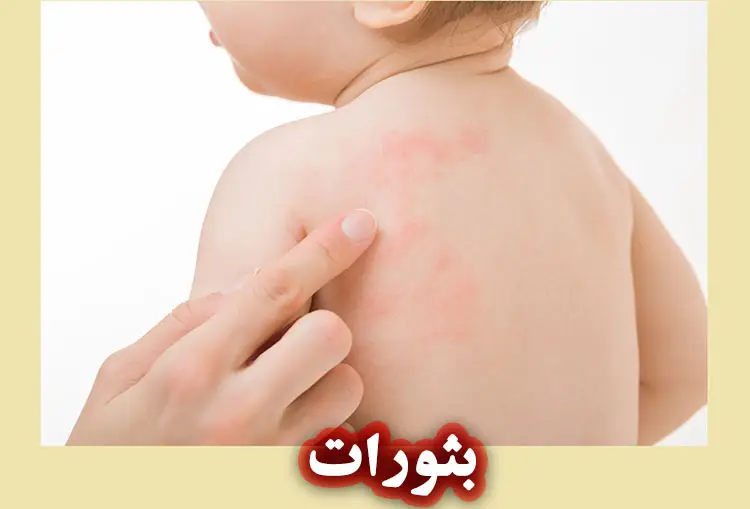 بثورات چیست؟