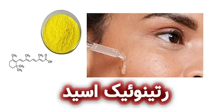 رتینوئیک اسید