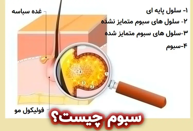 غده سبوم