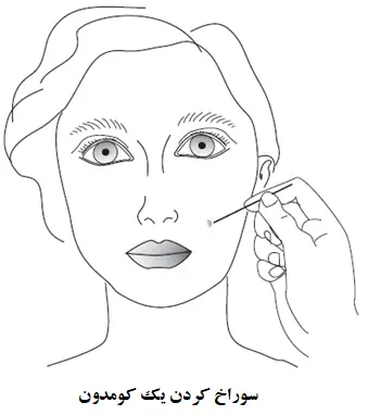 سوراخ کردن کومدون ها