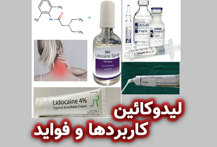 پادکست لیدوکائین