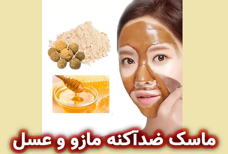 ماسک ضدآکنه مازو و عسل