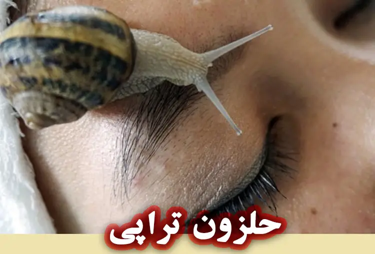 حلزون‌ تراپی