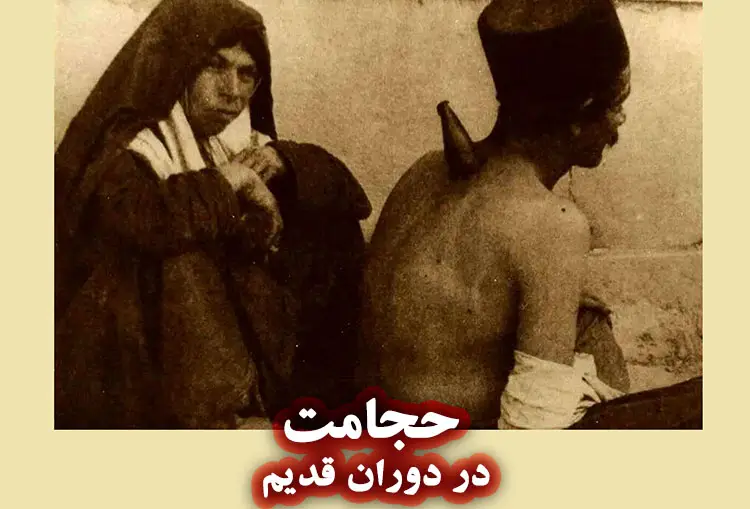 حجامت در تمدنهای باستانی