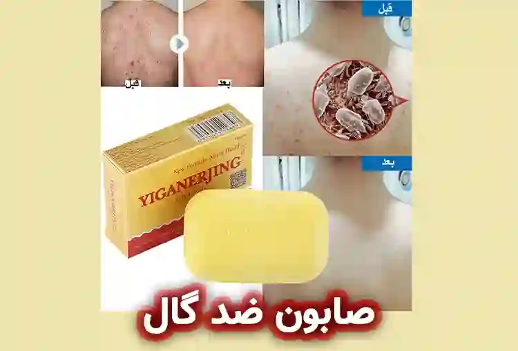 بهترین صابون ضد گال