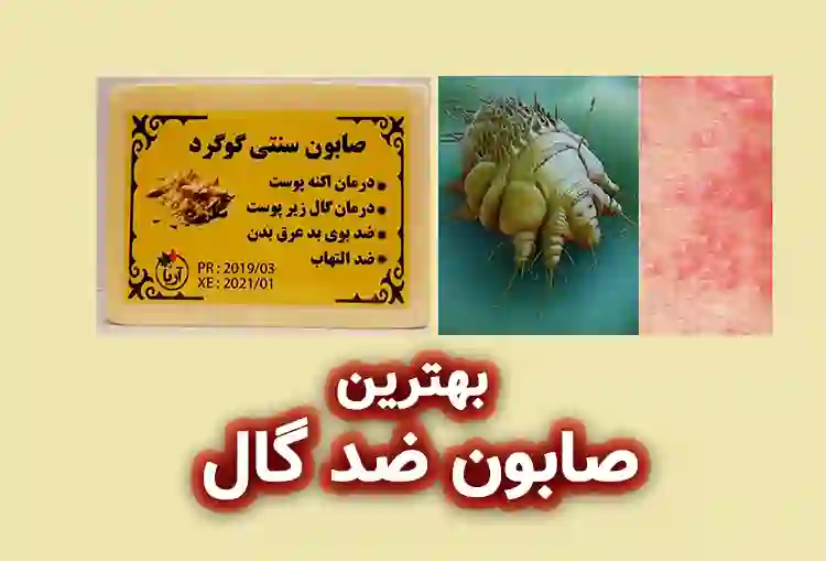 بهترین صابون‌ ضد گال